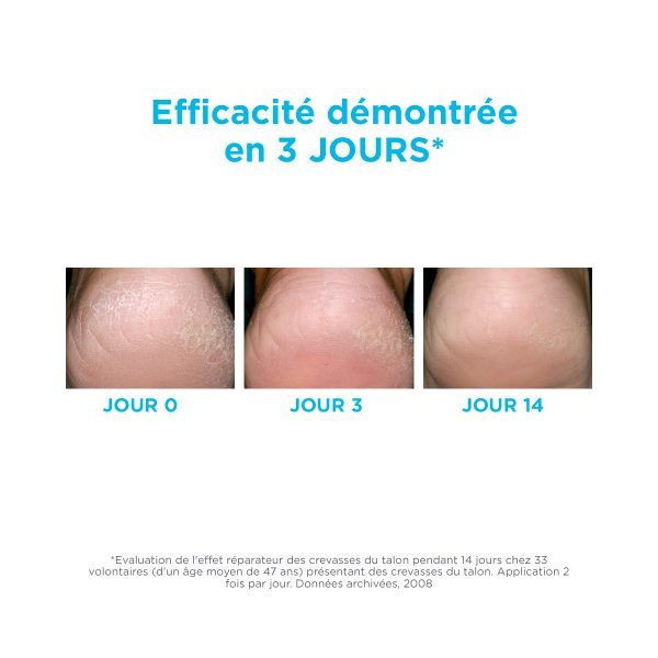 ISDIN UREADIN PODOS GEL OIL PIEDS 75mL – Image 2