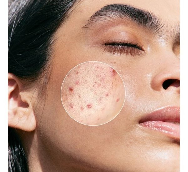 JANSSEN COSMETICS MASQUE PURIFIANT INTENSE 75ML – Image 2