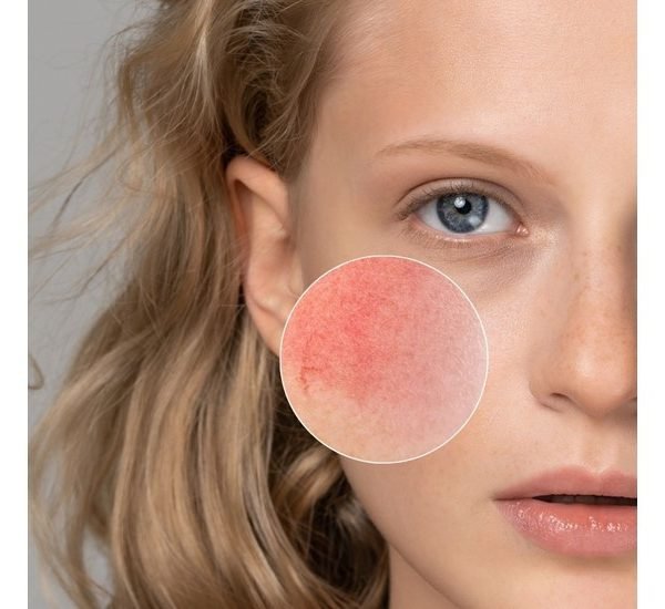 JANSSEN COSMETICS SERUM COUPEROSE QUOTIDIEN 30ML – Image 2